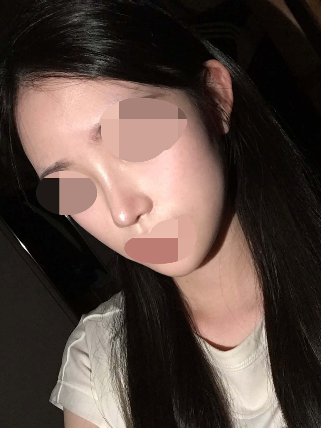 흉터가 하나도 없어서 너무 좋았어요