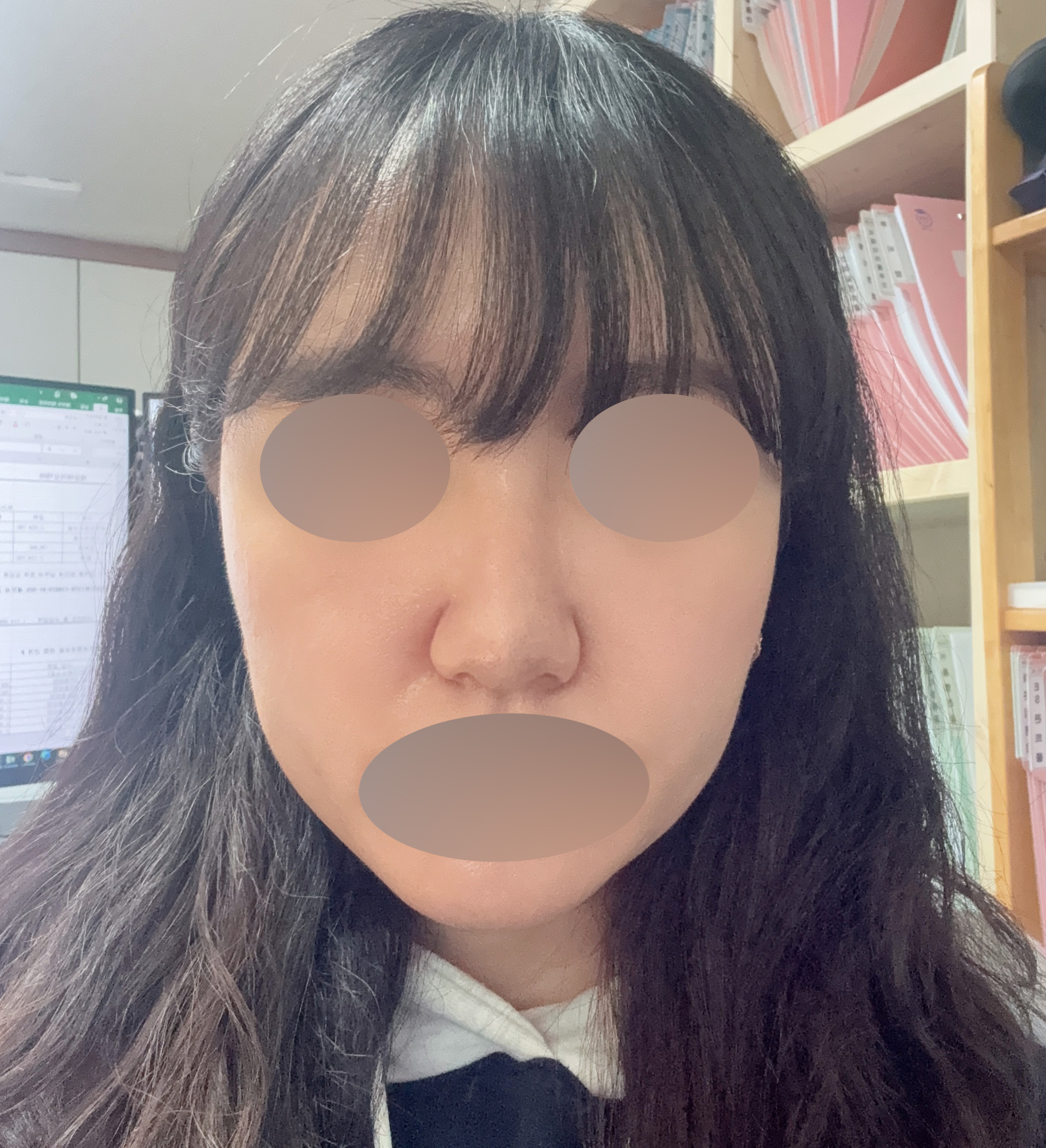 복코교정 2주차, 옆라인이 달라지는 과정