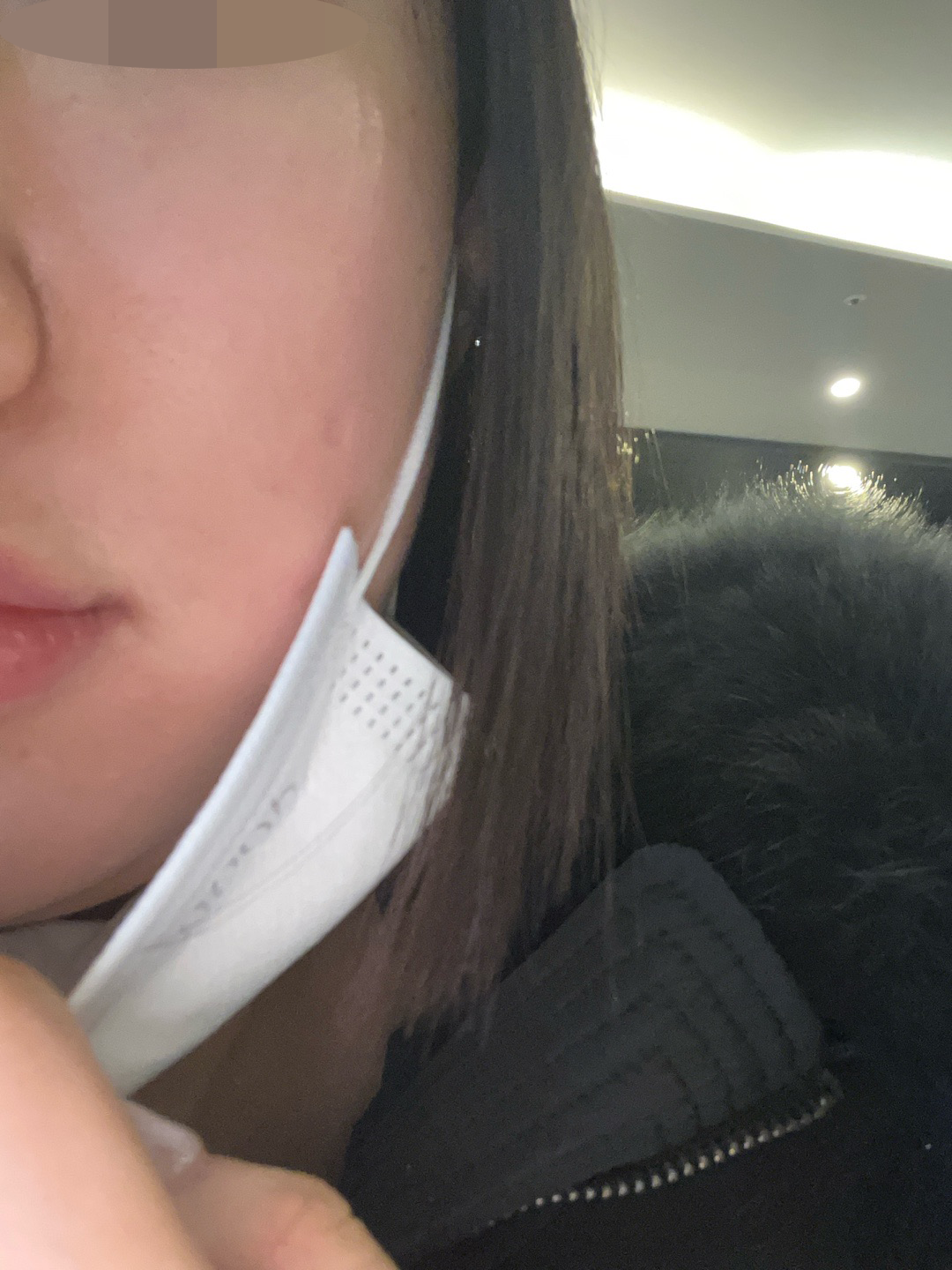 건조한 피부에 리쥬란 처방!! 재방문 예정입니다