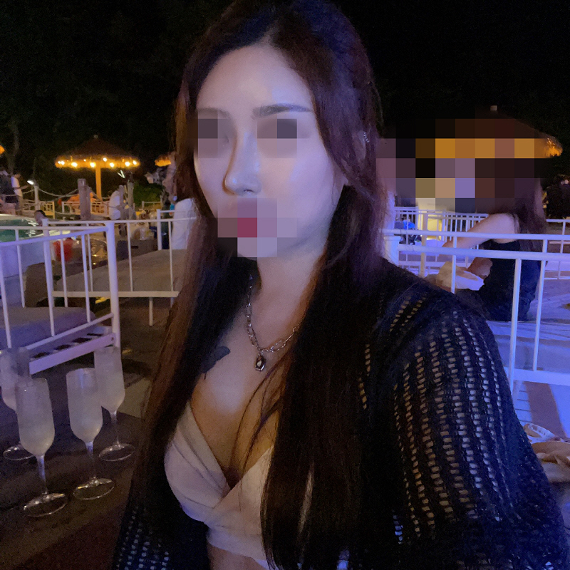 사후관리도 좋구요 코가 매달매달 바뀐다고 해서 더 기다리고 있는중입니다