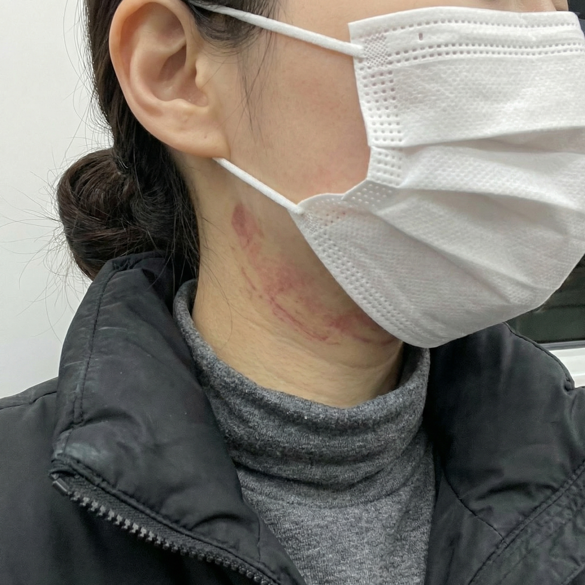 인생 첫 피부과 시술인데 다들 편하게 해주셔서 여기 정착하려고요~