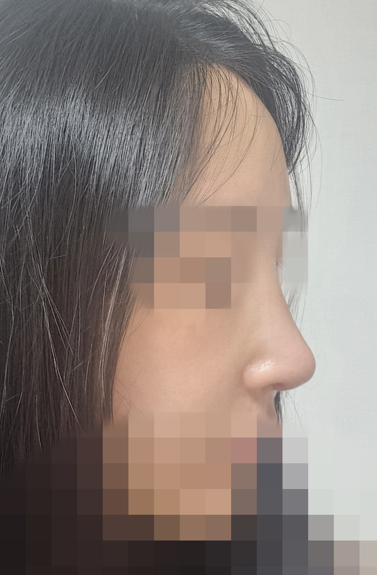 코끝 정말 깔끔하고 맘에 들어요~~