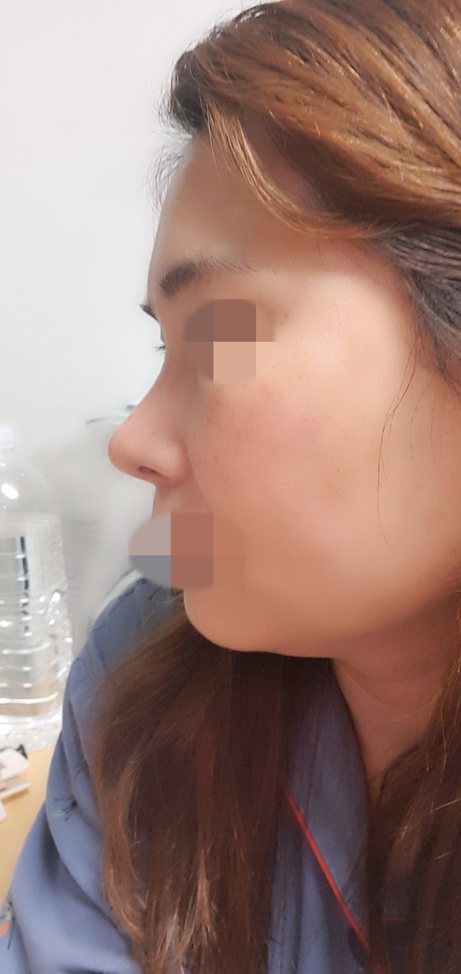 수술했는데 넘 친절히 잘해주셨어요