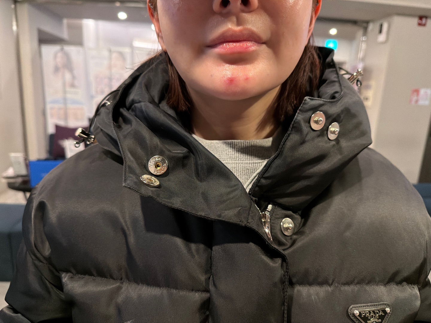 원장님부터 직원분들까지 다 친절! 볼뉴머리프팅 잘 받고 왔어요