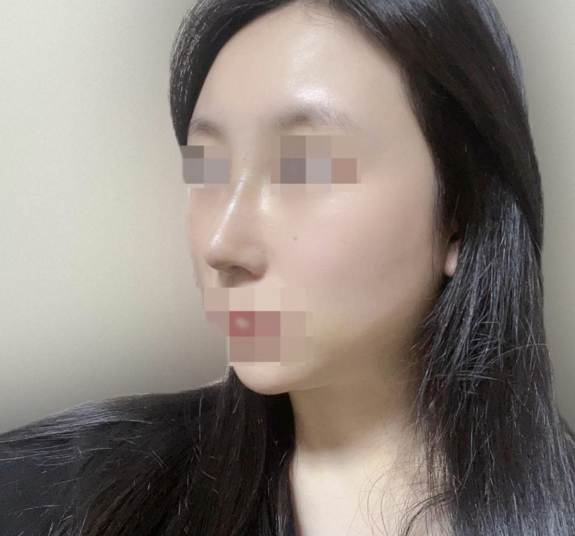 또렷하게 개선된 것 같아 만족합니다 ^^