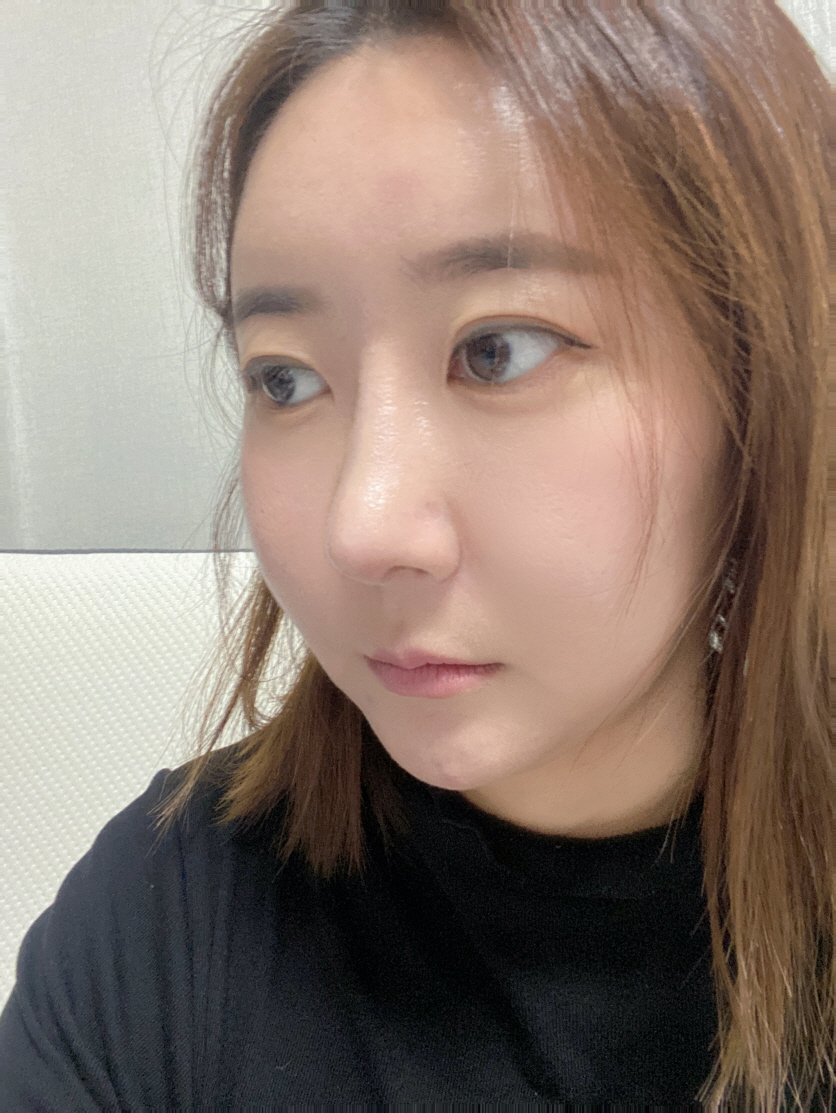 과하지 않고 자연스러우면서도 적당히 화려해서 주변에서 병원 많이 물어봐요!!