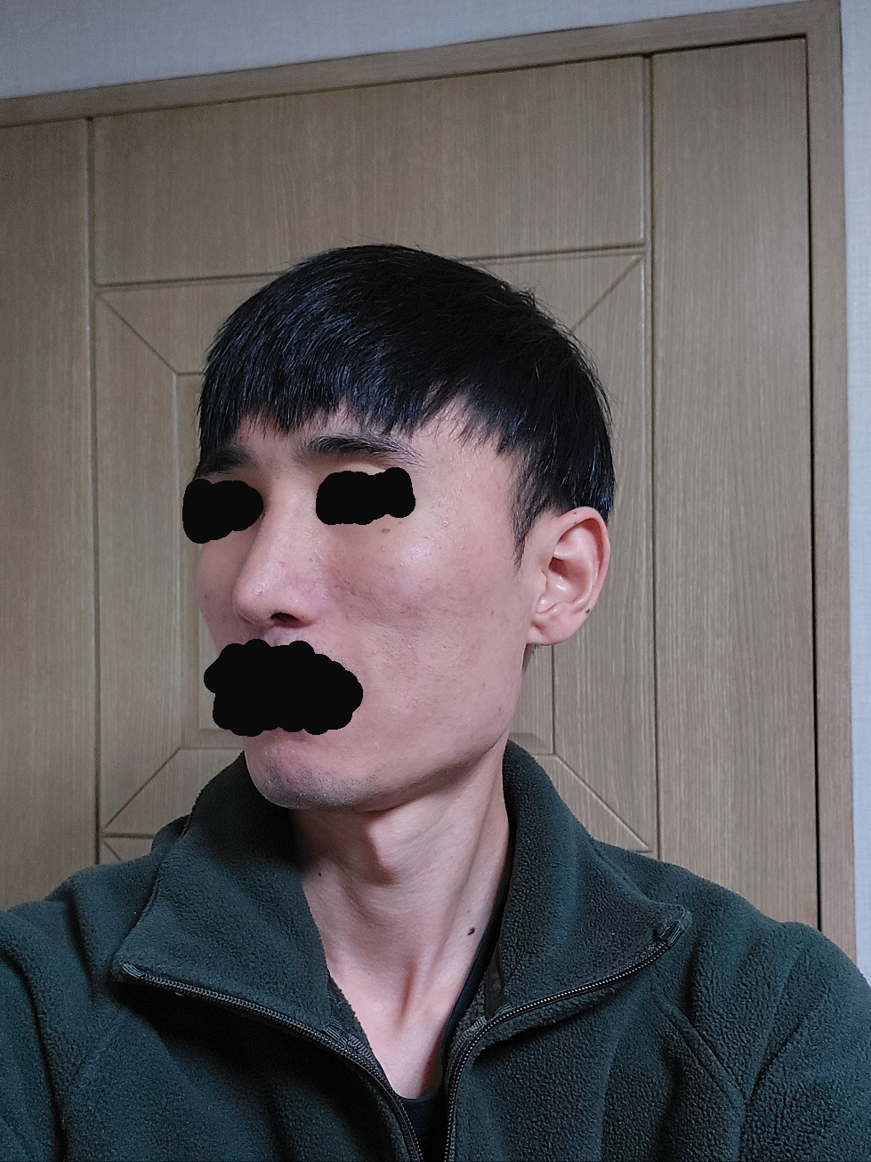 매부리코 단점이 극복되서 좋습니다