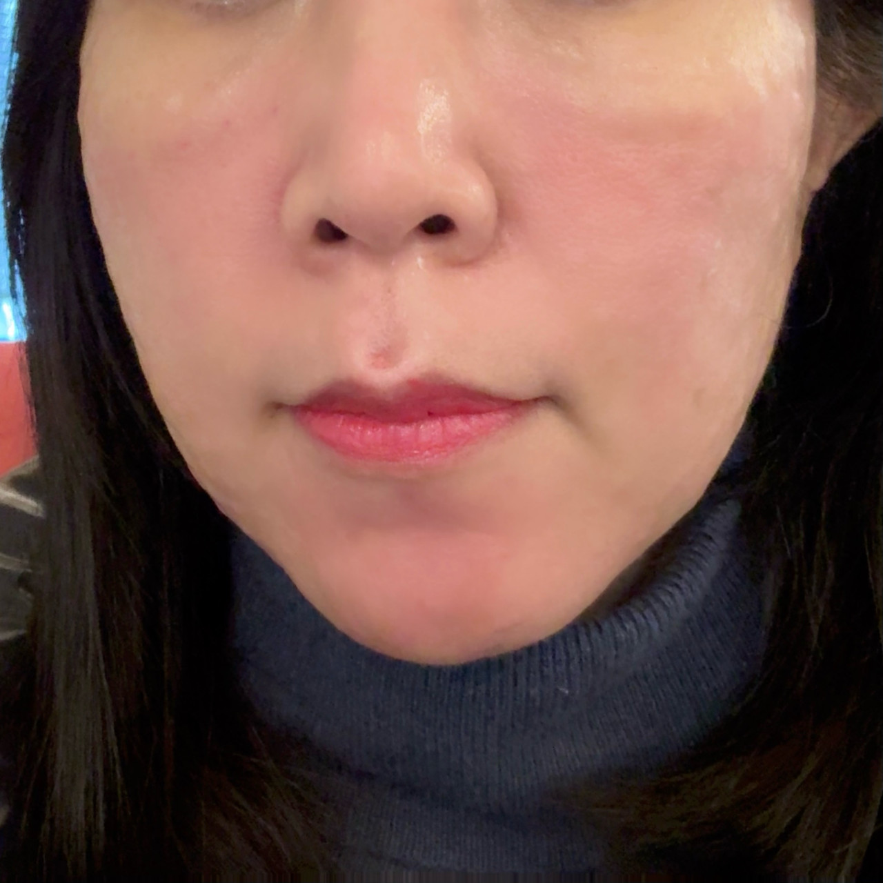 의사쌤 상담부터 꼼꼼함까지 완벽! 믿고 맡기는 피부 관리