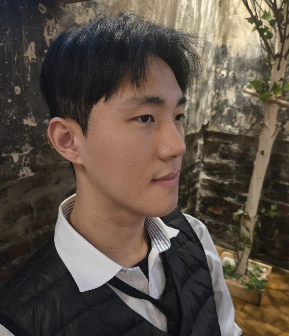 남자 코성형 3달차, 붓기와 통증 없이 회복 중입니다.