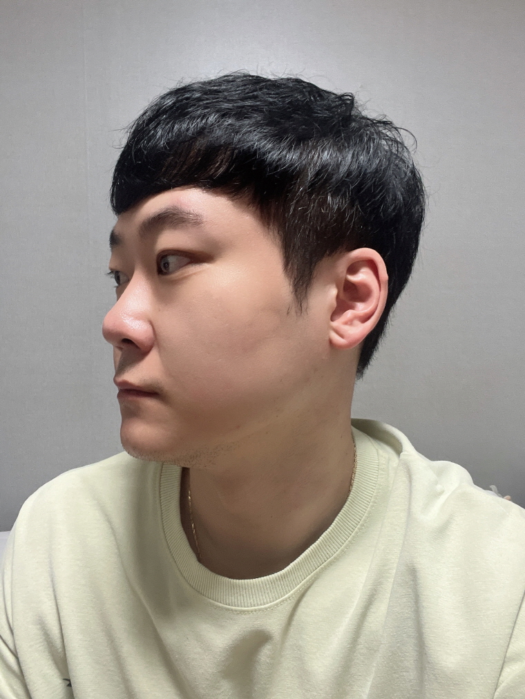 너무 친절하시고 믿고 했는데 결과도 잘 나와서 이 병원 완전 강추!!