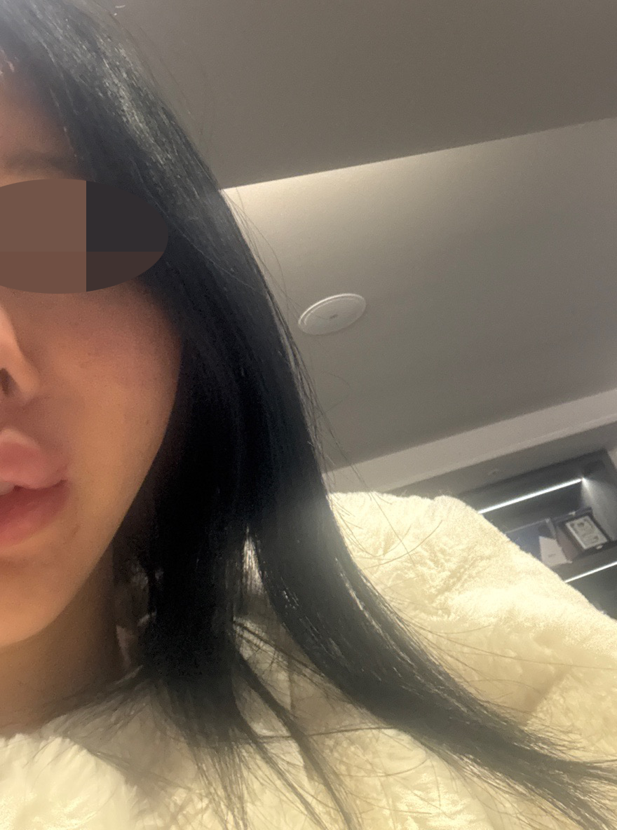항상 받는 곳 에서 또 실리프팅 받고 왔어요~ㅋㅋ