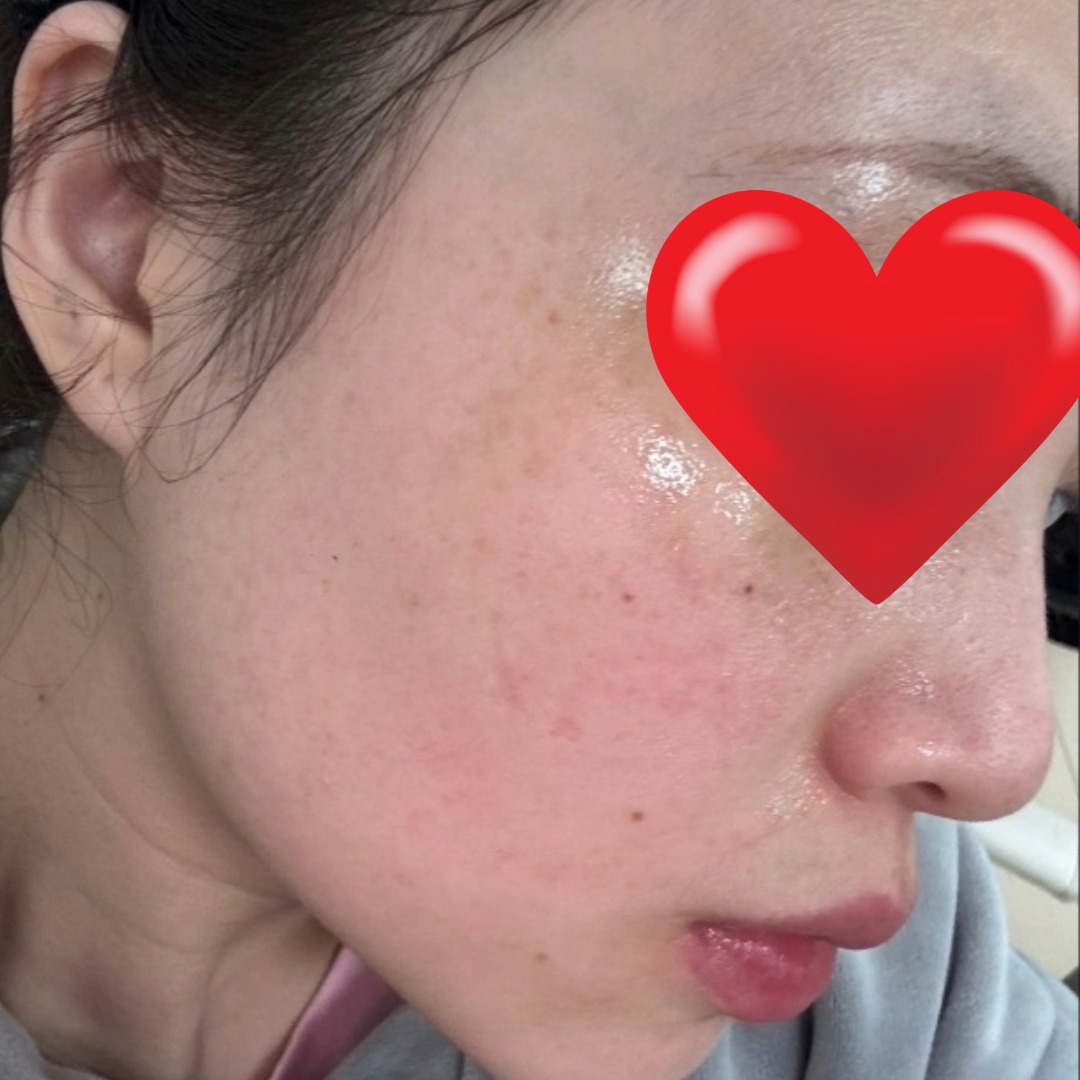아파도 포기 못하는 이유.. 효과 확실하고 직원분들 천사표