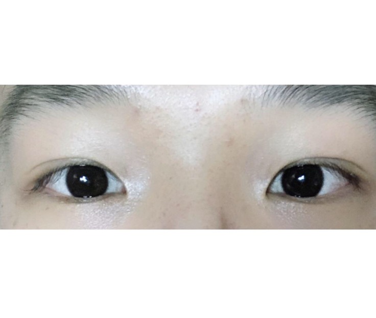 쌍수