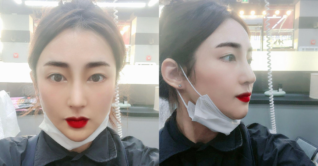 휜코 교정으로 자존감 넘칩니다!