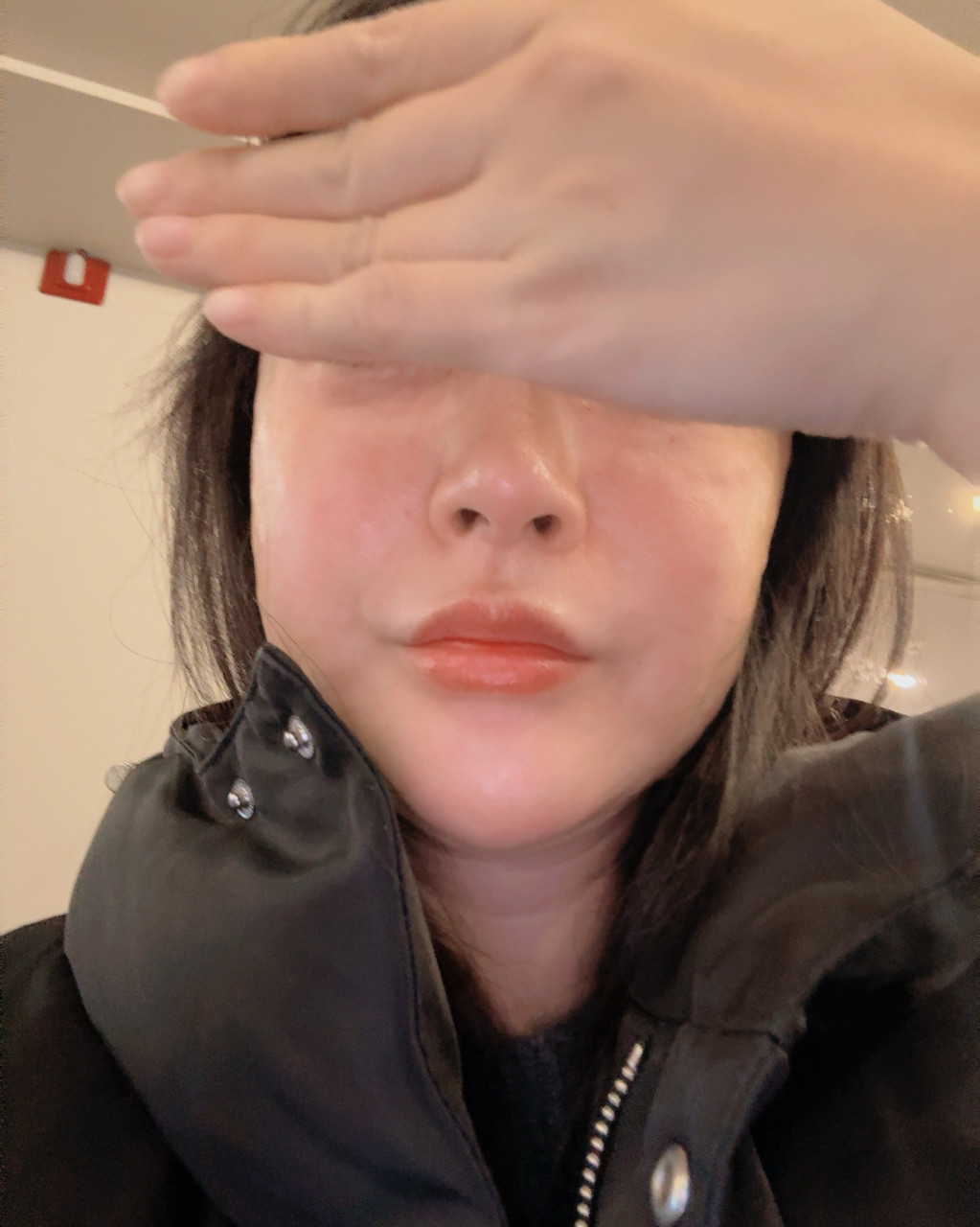 리쥬란 꼼꼼하게 잘해주셔서 계속 여기서 맞아요ㅎㅎ