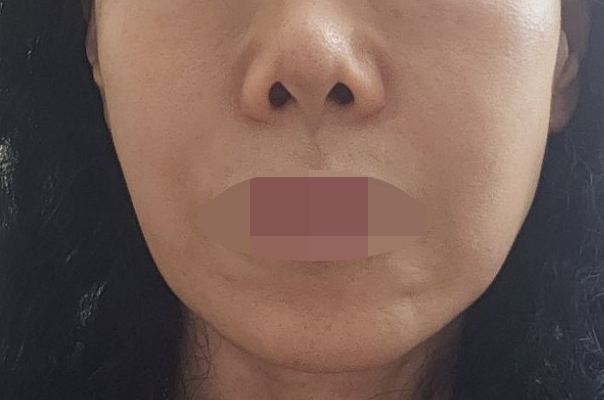 딸이 추천해서 연어주사 받는데 효과 좋아서 단골이에요 ㅎㅎ