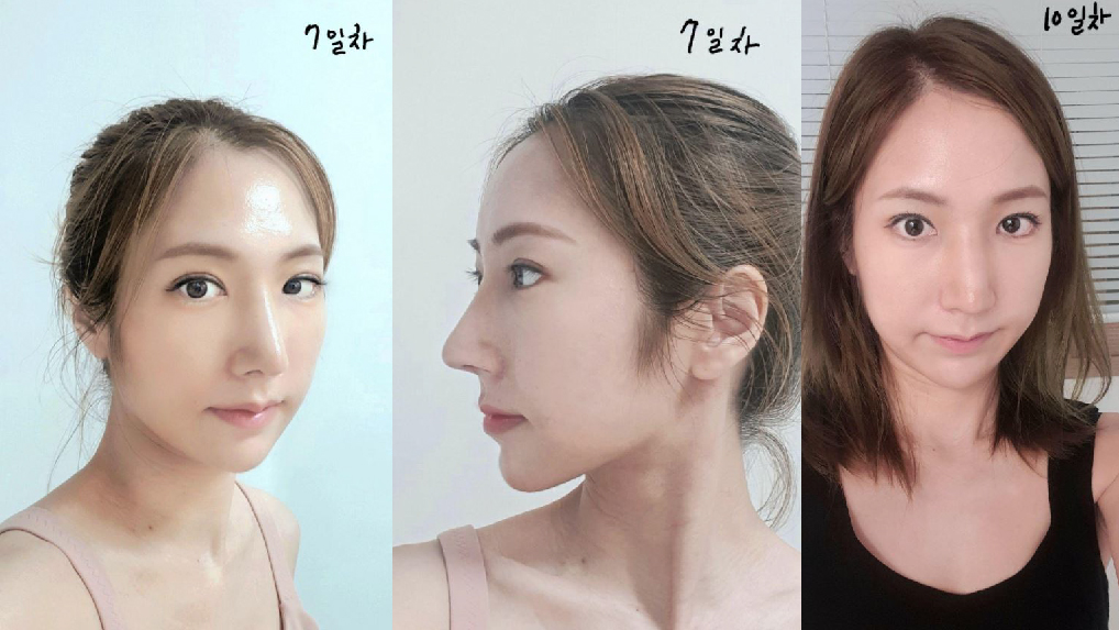 황원장님께 눈코받았어용