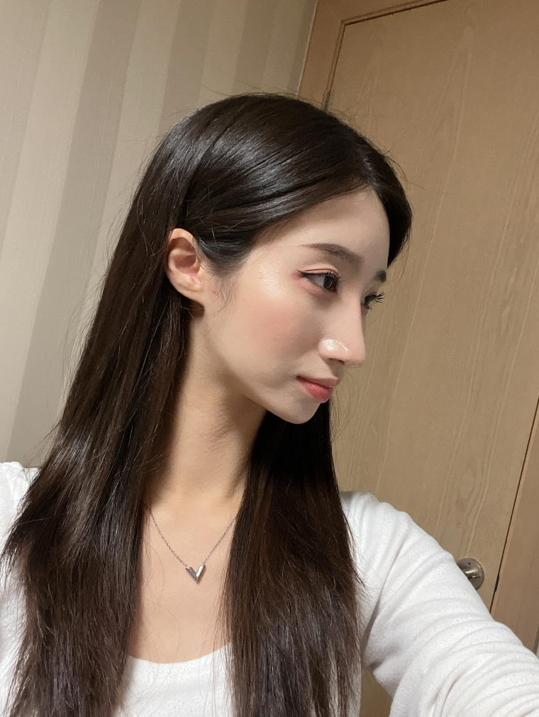 과하지도 않고 얼굴형에 맞는 코수술을 받아서 좋은 것 같아요 !