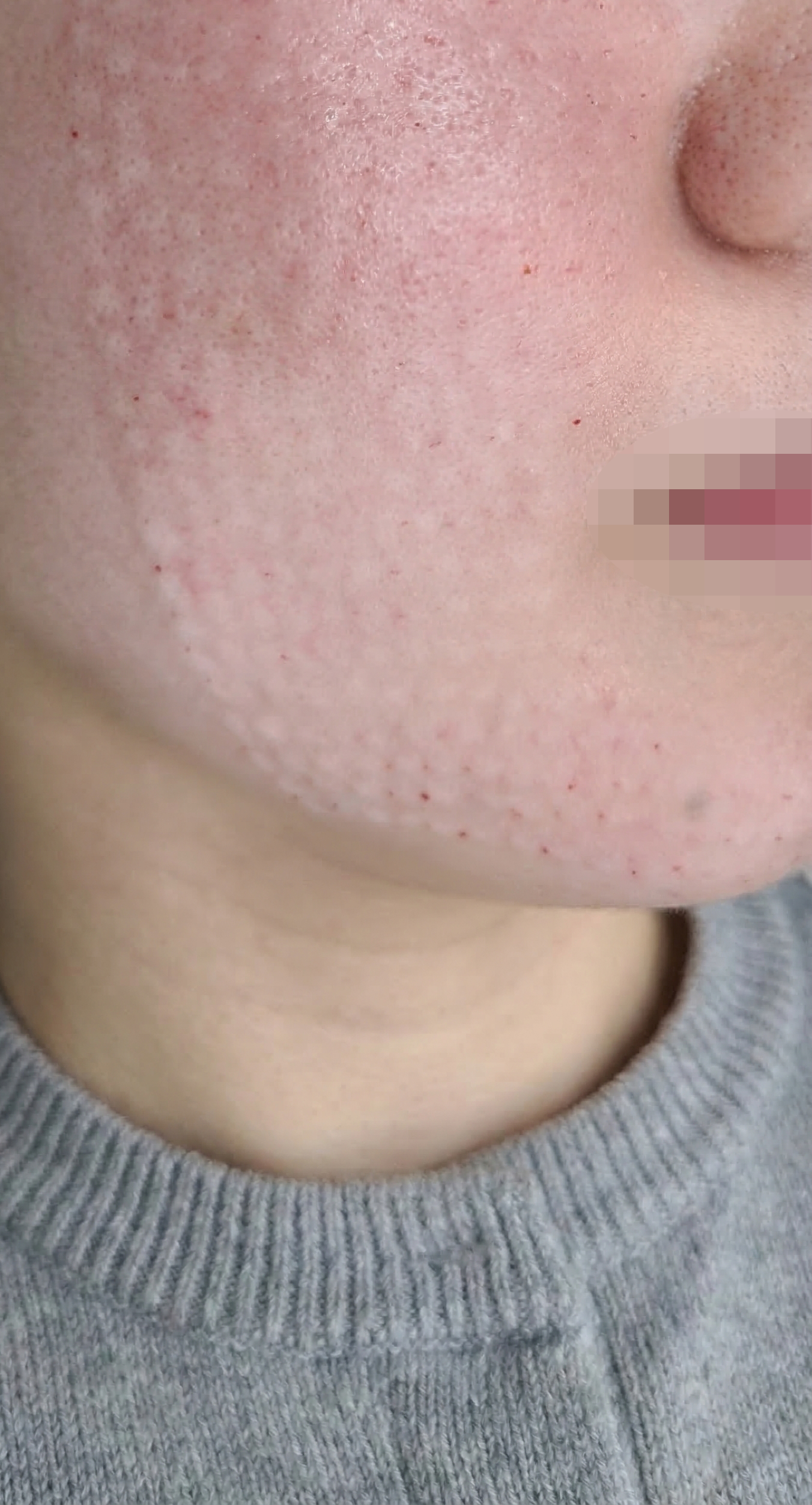 정품 개봉 보여주시고 진정 케어까지 해줘서 만족이에요!