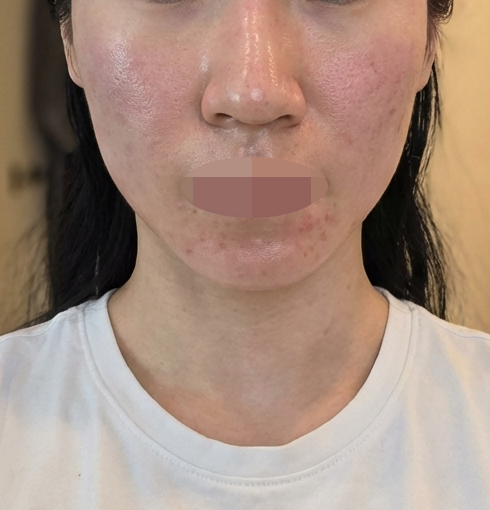 포텐자 받았는데 세안실도 있고 편해서 만족이에요~