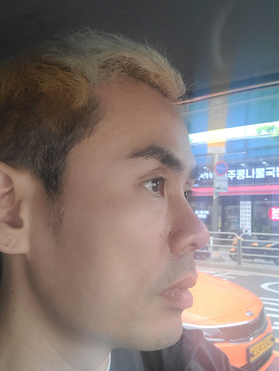 한달되니 불편한거 없고 코가 이뻐진거 같습니다~^^