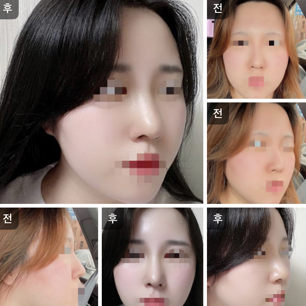 서울아이 코 짱짱맨