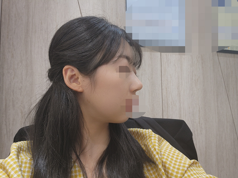 3개월이 지난 시점에 지금은 정말 많이 자연스러워졌어요!