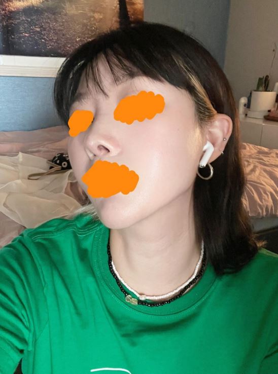 3번째 재수술 끝에 찾은 내병원!!