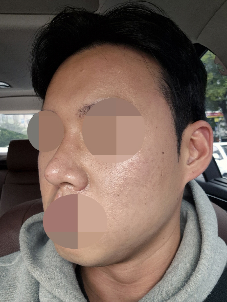코가 더 예뻐졌습니다!
