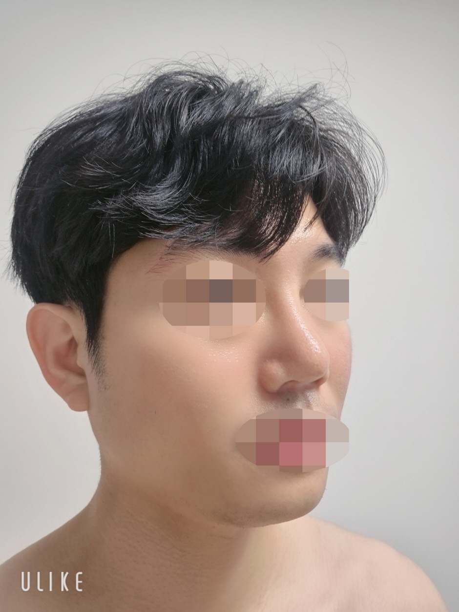 세심하게 케어해주셔서 자연스럽게 잘 자리잡았어요!
