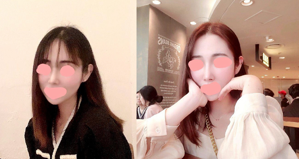 새 코와 새 삶 감사합니당~!!!