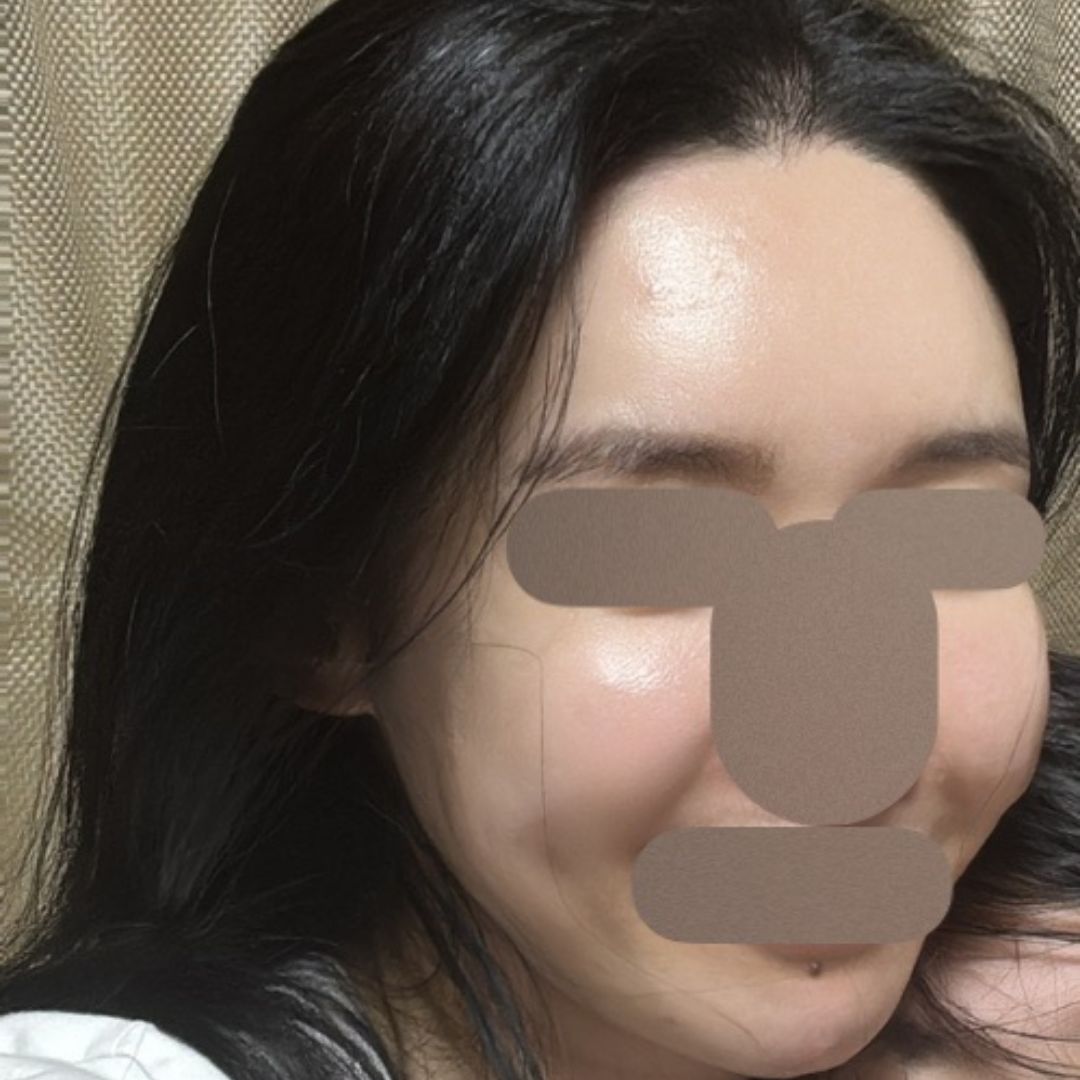 집 근처라 자주 찾는 편한 최애 성형외과