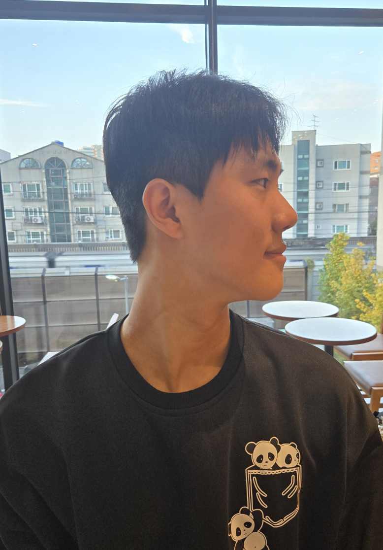 남자 코성형 1개월차! 붓기 빠지니 더 마음에 듭니다!