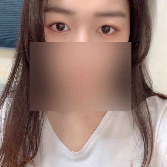 눈이 전보다 더 뚜렷해졌어요!