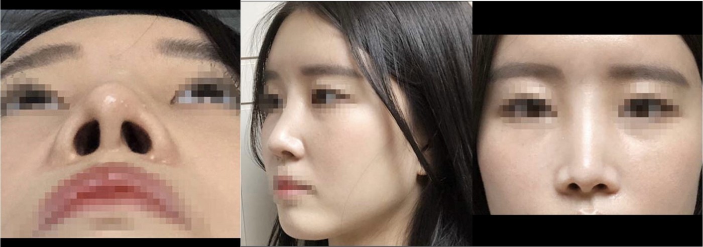 코랑 풀페지이했어요