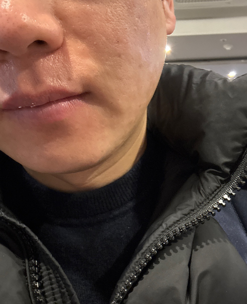나이 들어서 시술 시작했는데 편하게 받았습니다~