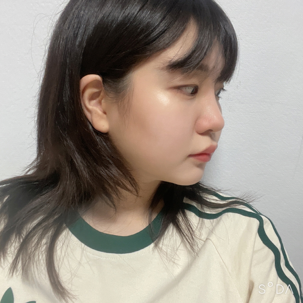 수술 전 사진을 보면 달라진 점이 보이는 것 같아서 신기합니당