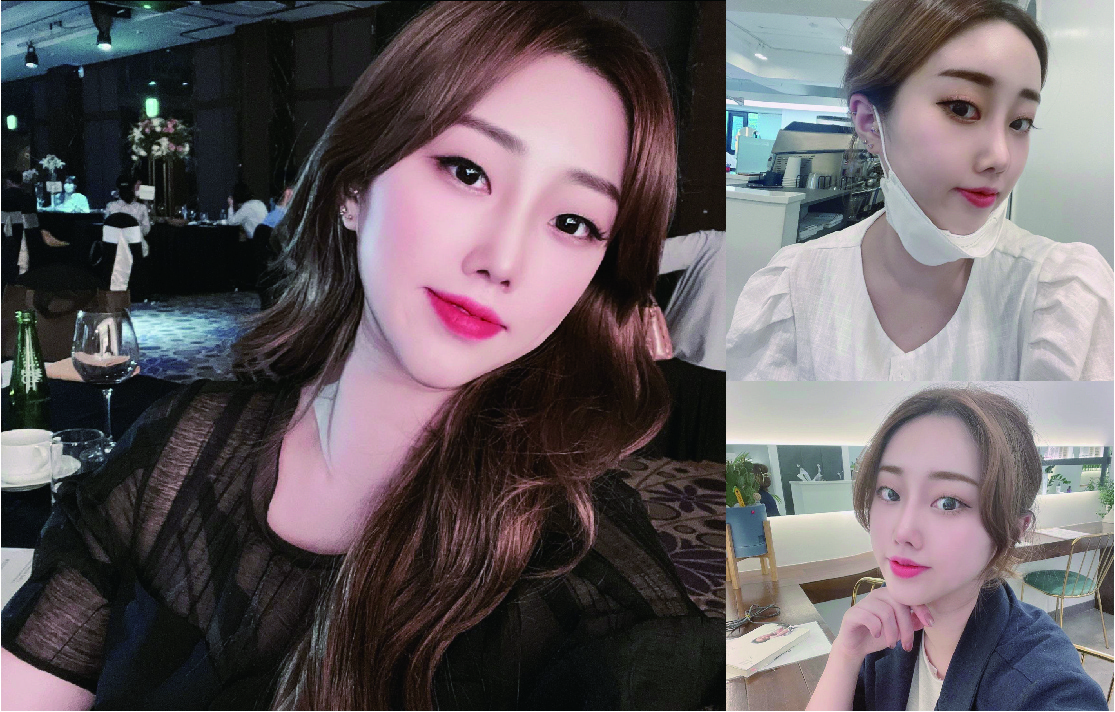 수술 두달째 매일이 즐겁습니닼ㅋ