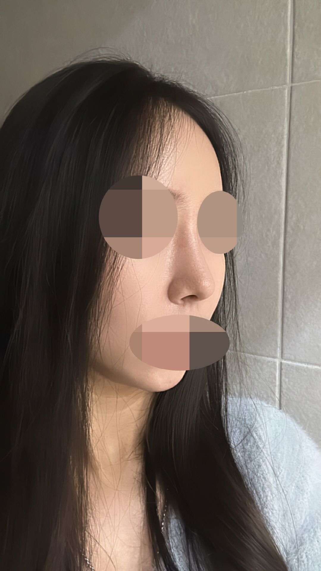 피부 감각도 많이 돌아오고 예쁘게 잘 정리됐어요 ㅎㅎ