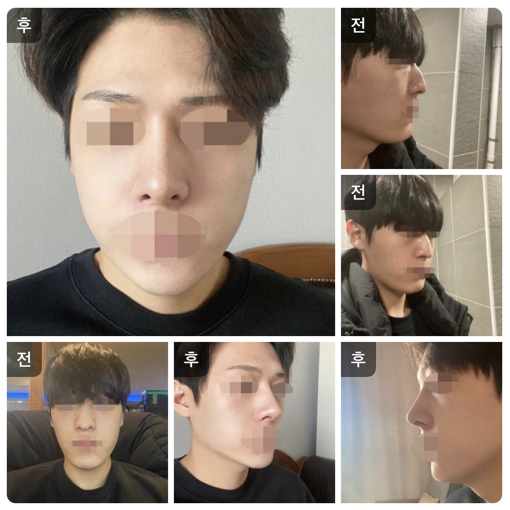 2월에 받은 코 후기