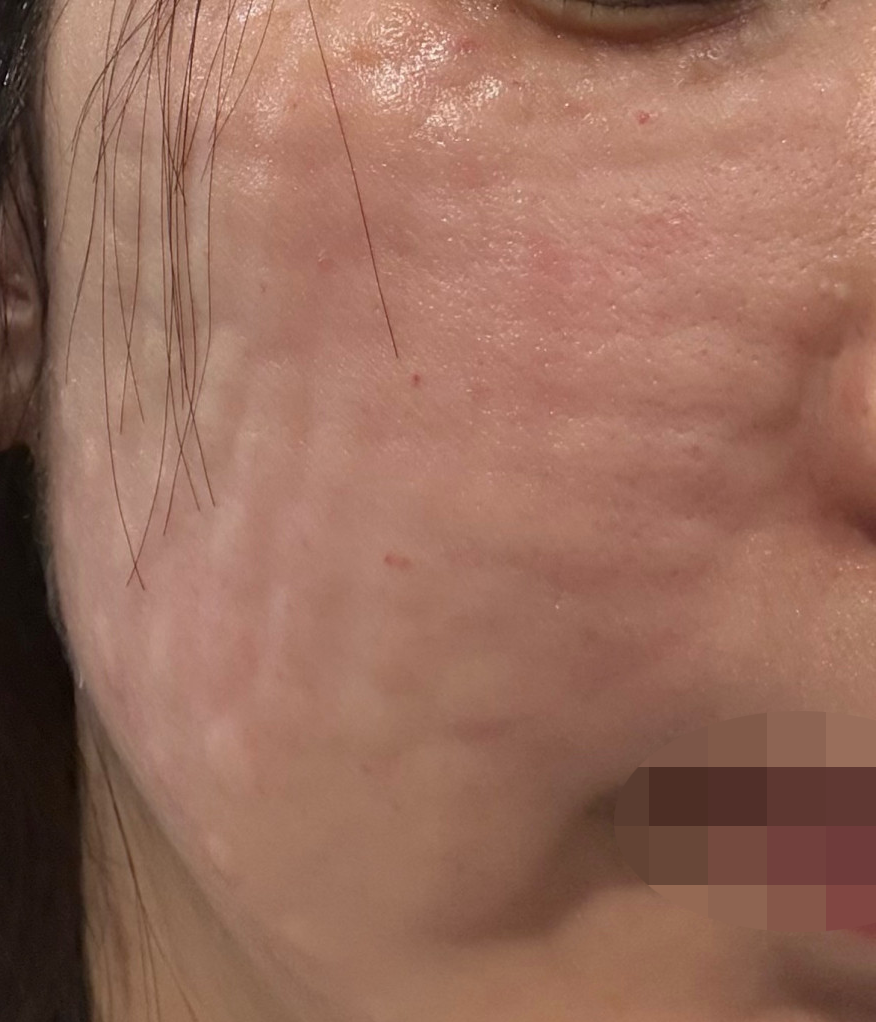 정품인증 확인시켜주시고 코드도 주셔서 믿음이 가요! 다음엔 리쥬란 또 받아보려고요ㅎㅎ