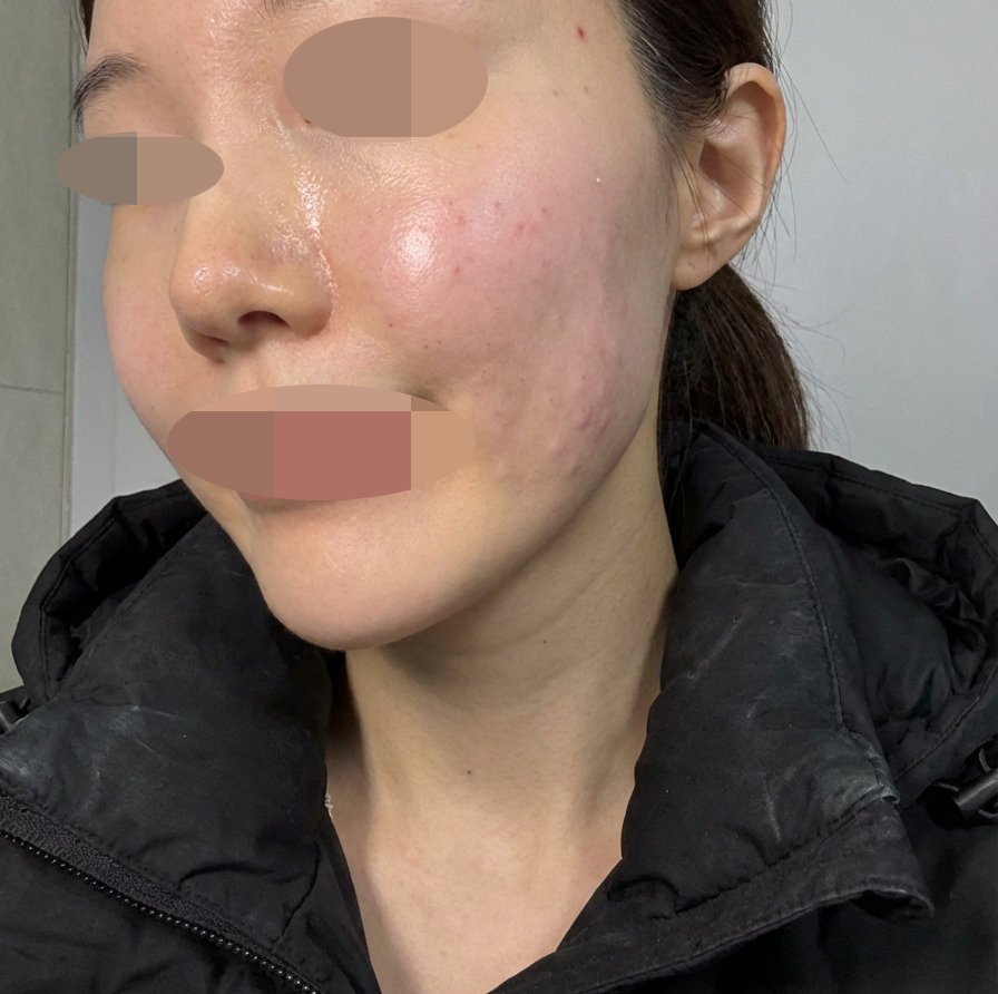 겁쟁이도 편하게 받을 수 있는 곳이라 너무 좋았어요~!!
