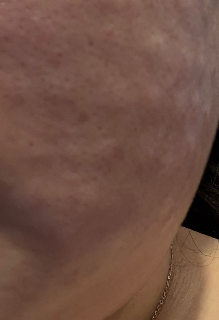 친절한 응대 덕분에 리쥬란 편하게 받아봤어요ㅎㅎ