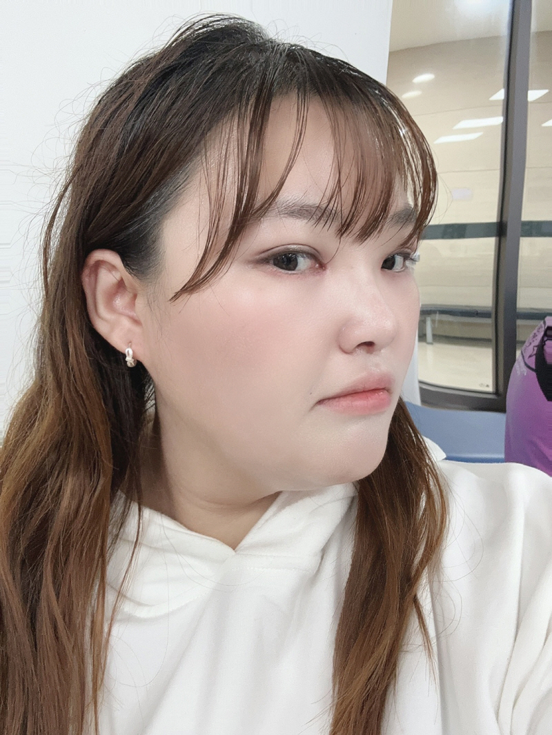 미용효과와 기능적인 면 둘다 효과를 보게 되어서 제일 만족하고 있어요
