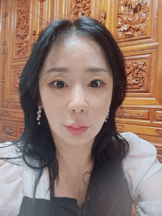 원하는 모양대로 디자인해주셔서 붓기가 빠지면 더 이뻐질 것 같아요.