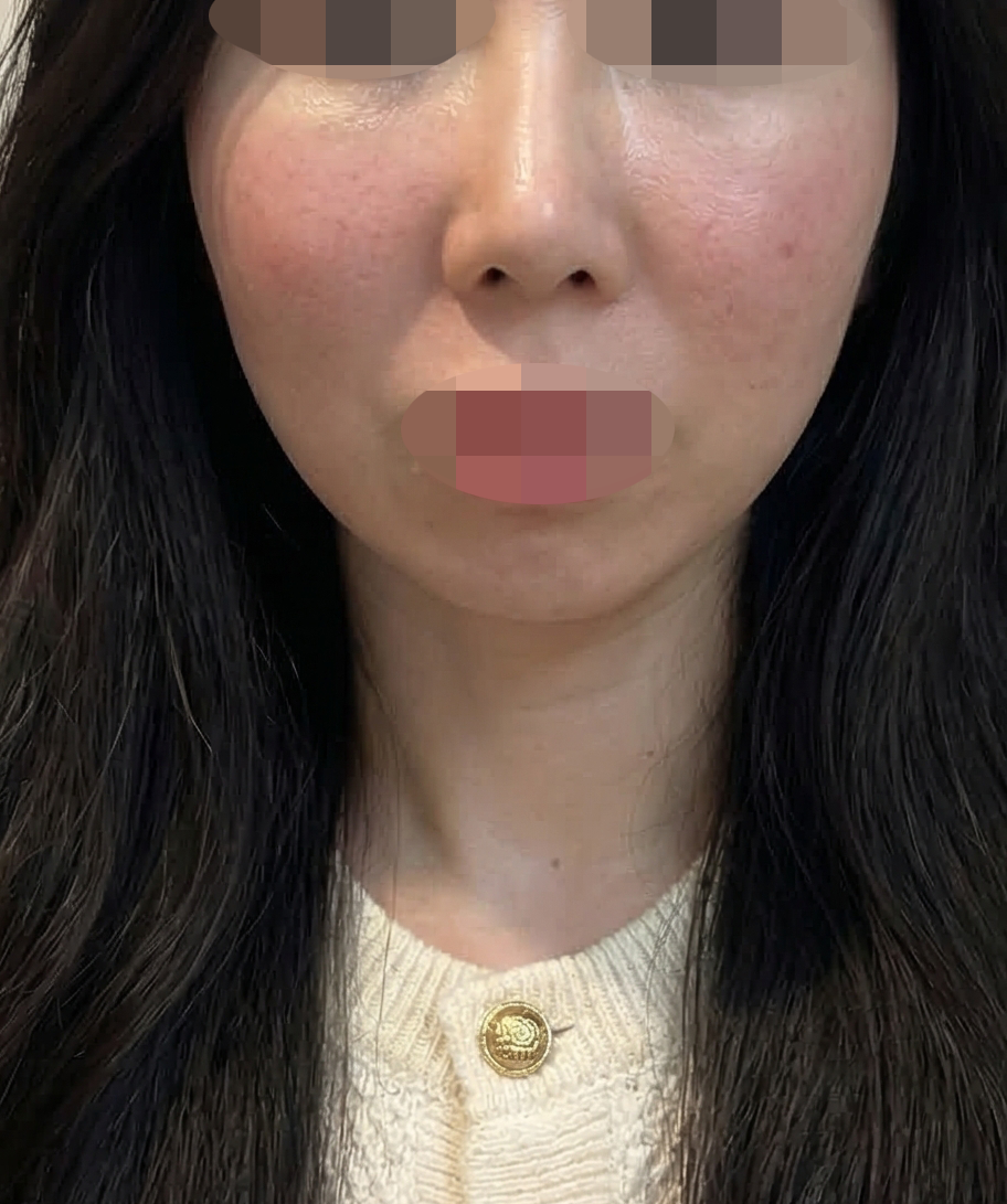 LDM 받았는데 친절하고 대기 없어서 안심하고 받았어요 ㅎㅎ