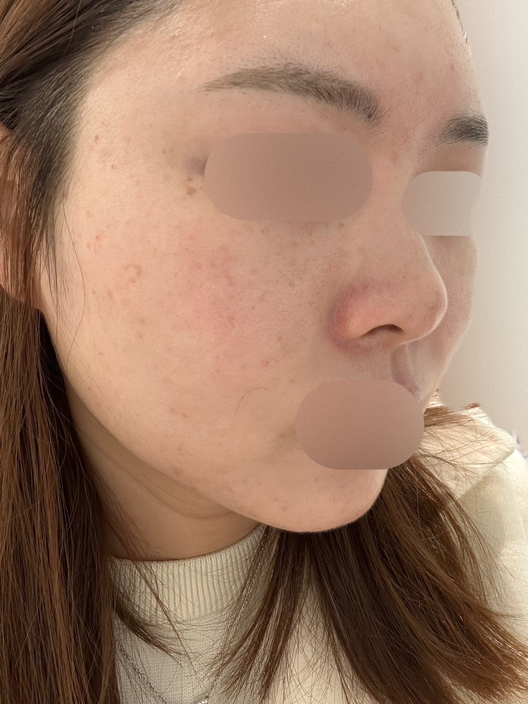 주위에서도 피부 예뻐졌다고 할 만큼 효과 좋아서 재방문했어요!