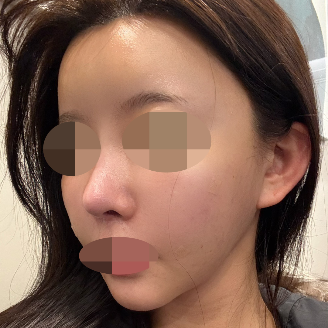 피부 건조해서 스킨바이브 받았는데 만족인 것 같아요!ㅎㅎ