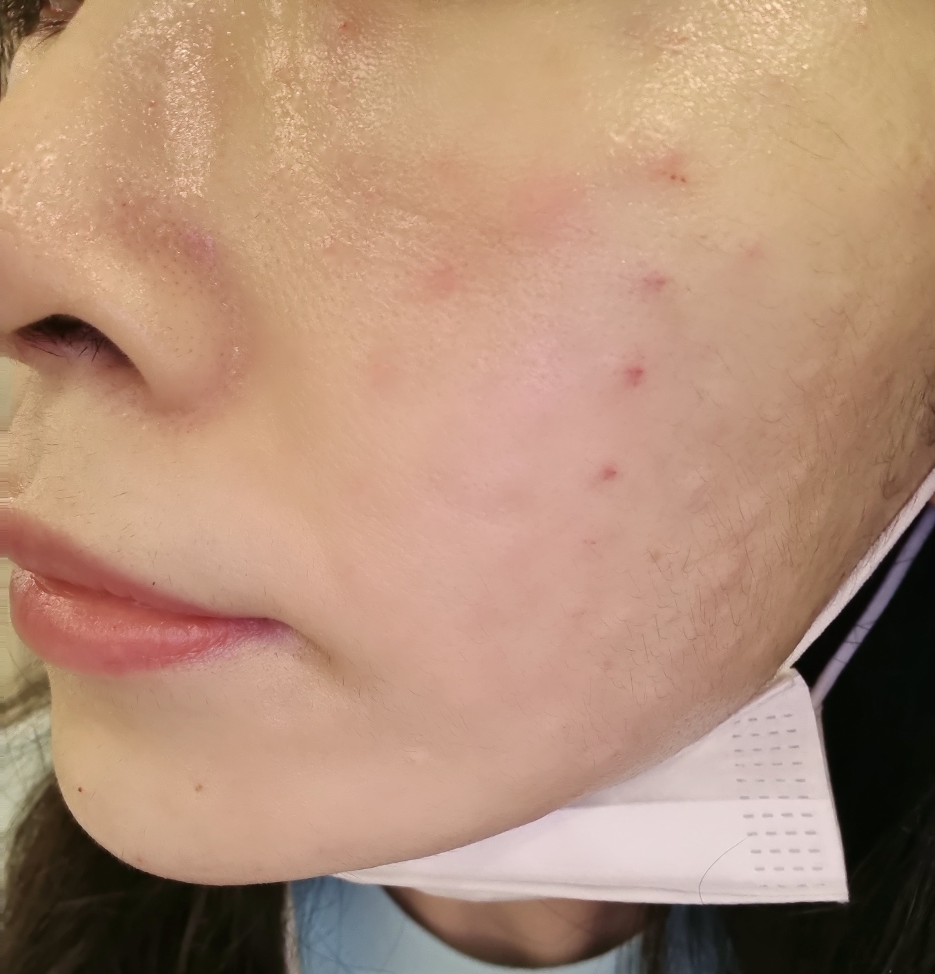 여름철 모공이랑 과잉피지 고민으로 쥬베룩스킨 받아봤어요~