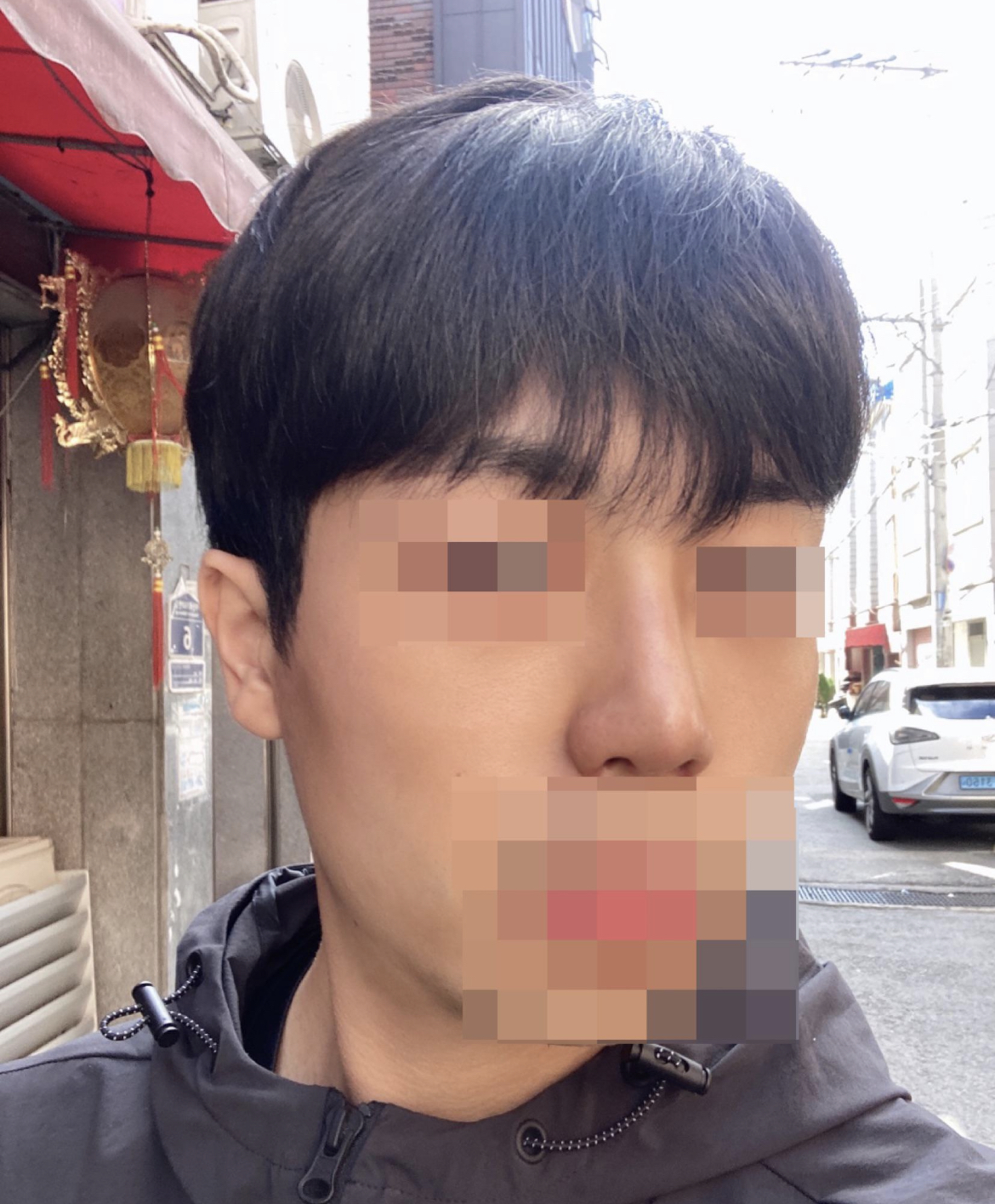 병원 회복,치료시스템도 깔끔하게 잘 되어있어서 회복하는데 어려움이 없었습니다 !